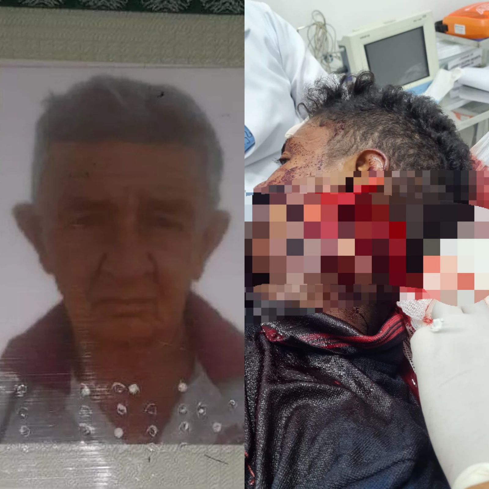 José Rosaldir morreu e João da Cruz ficou gravemente ferido em briga de facão em Alto Longá - Foto: Reprodução