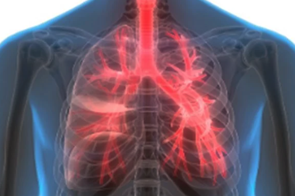 Caso inusitado: Jovem de 20 anos sofre enfisema pulmonar ao se masturbar- Foto: Reprodução/Metrópoles
