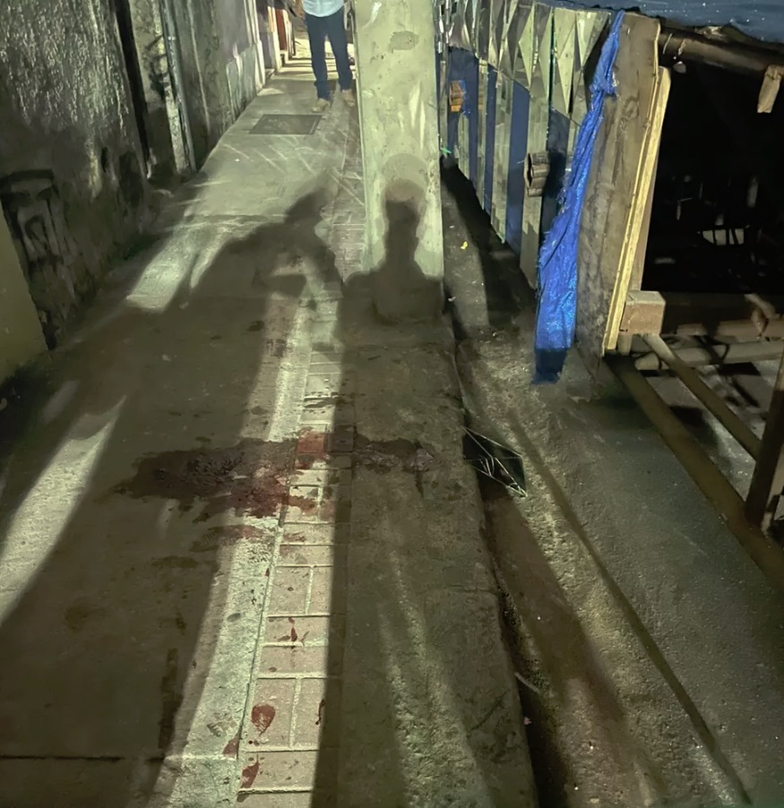 Menina foi atropelada pelo carro e prensada contra um poste - Foto: Lucas Soares/TV Globo