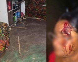 Homem é preso após agredir esposa e sogra com pedaço de madeira no Piauí
