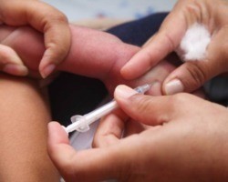 Ministério da Saúde reduz quantidade de vacinas BCG enviadas ao Piauí