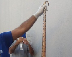 Idoso de 70 anos é salvo por filho ao ser atacado por cobra no Piauí
