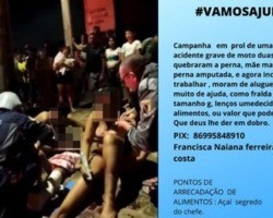 Família faz campanha após pai ter a perna amputada em acidente em Teresina
