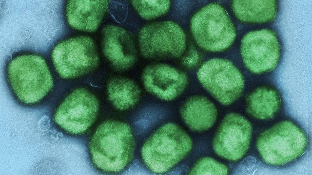 Brasil investiga mais um caso suspeito da varíola dos macacos - NIAID-NIH