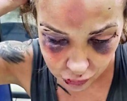 Mulher é agredida com soco inglês e cassetete por 3 dias;namorado foi preso