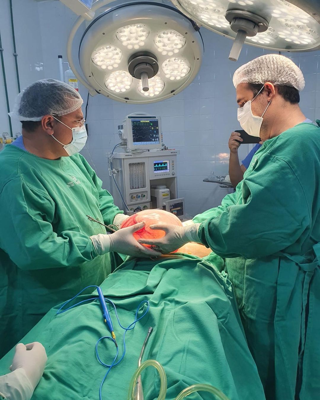 Médicos retiram cisto gigante de 5 kg de idosa no Sul do Piauí (Foto: Hospital Regional de Bom Jesus)Médicos retiram cisto gigante de 5 kg de idosa no Sul do Piauí (Foto: Hospital Regional de Bom Jesus)