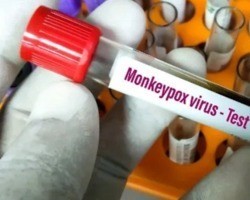 Piauí monitora avanço de casos da “varíola dos macacos”
