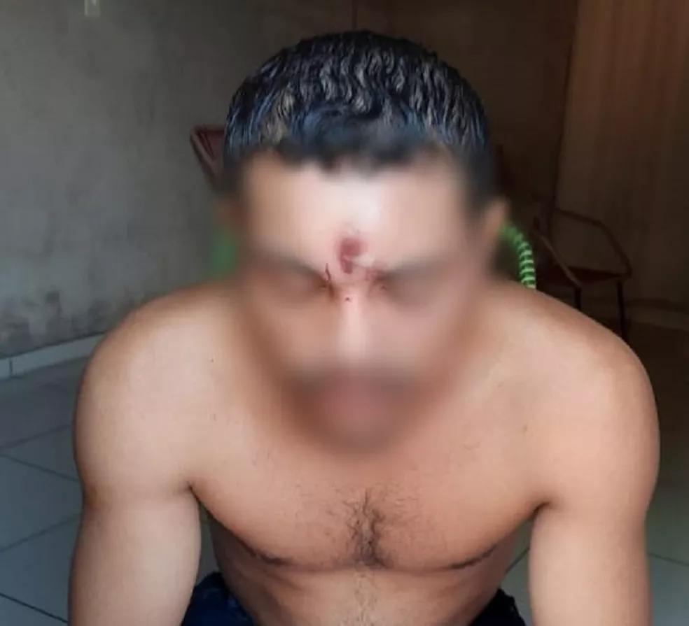 Homem levou tiro na testa e sobreviveu em Araguaína - Foto: Reprodução