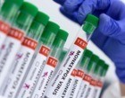 Fiocruz realiza produção de insumos para diagnóstico da varíola dos macacos