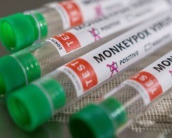 OMS: Brasil está entre os países com mais casos de varíola dos macacos