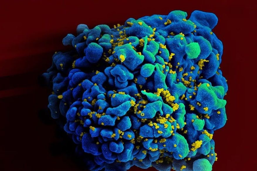 Cientistas anunciam quarto caso no mundo de cura de paciente com HIV (Foto: Divulgação)