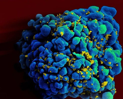 Cientistas anunciam quarto caso no mundo de cura de paciente com HIV