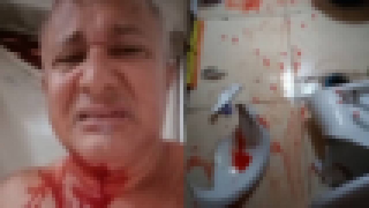 Jornalista Walcy Vieira cai em banheiro e bate a cabeça em vaso em Teresina (Foto: Arquivo Pessoal)
