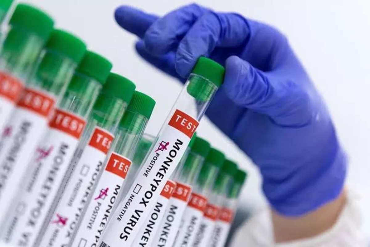 Quem receberá a vacina contra a varíola dos macacos no Brasil? - Foto: Reprodução/Agência Brasil