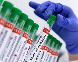 Quem receberá a vacina contra a varíola dos macacos no Brasil?