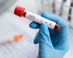 Homem é condenado pela morte da esposa após transmitir HIV conscientemente
