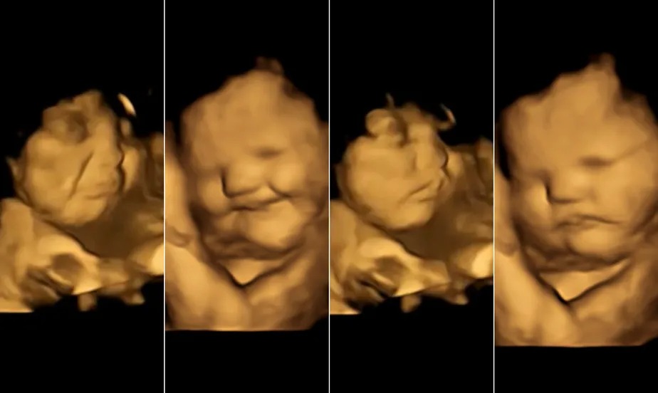 Bebês reagem a sabores de alimentos com expressões faciais ainda dentro da barriga, mostra estudo inédito com ultrassom 4D. Divulgação / Estudo Fetal Taste Preferences (FETAP), Universidade de Durham