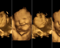 Bebês reagem a sabores com expressões faciais ainda na barriga da mãe