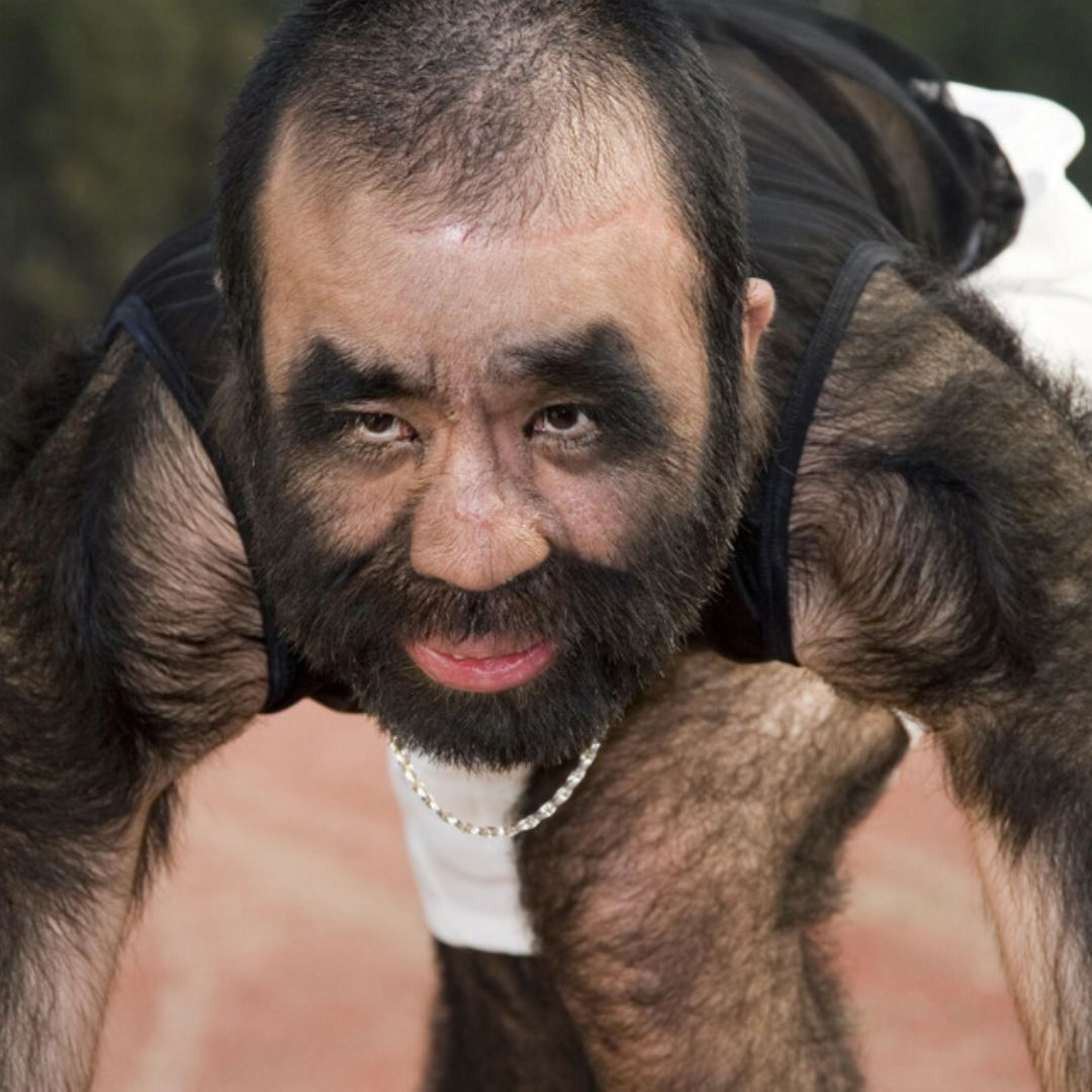 Veja pessoas cujos traços físicos extraordinários se destacam ...